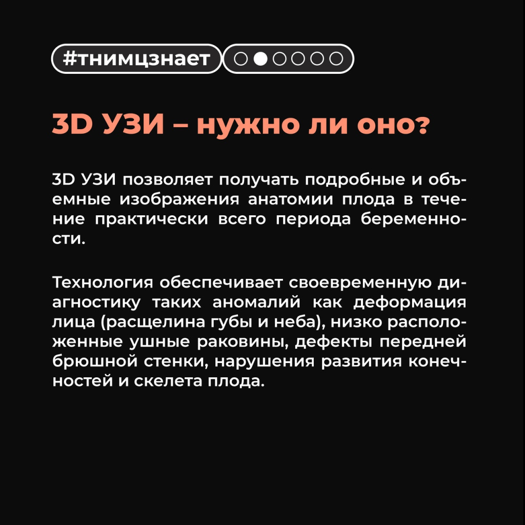3D Uzi 1.jpg